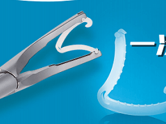 一(yī)次性結紮夾